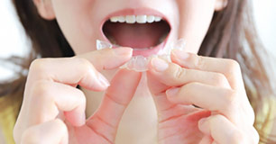矯正歯科・マウスピース